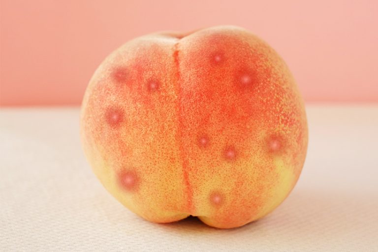 Butt Acne Sucks. Here’s How to Get Rid of It.