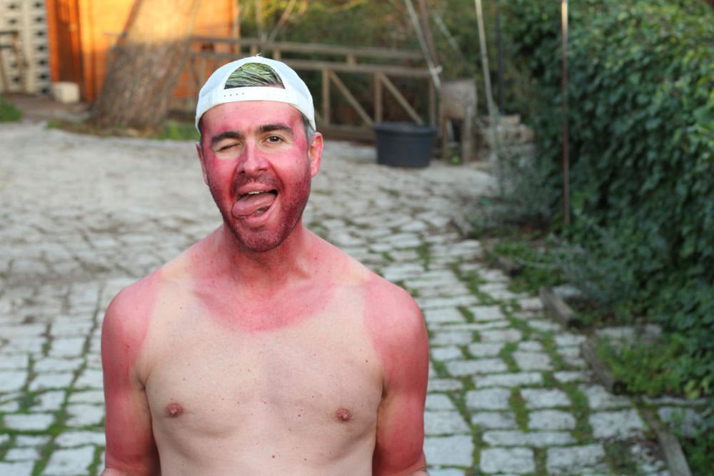 How To Get Rid Of Those Pesky Tan Lines