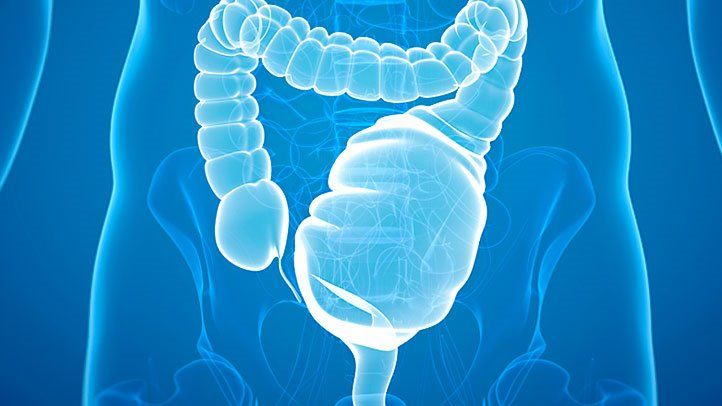 What's a Toxic Megacolon? (It's as Serious as It Sounds)
