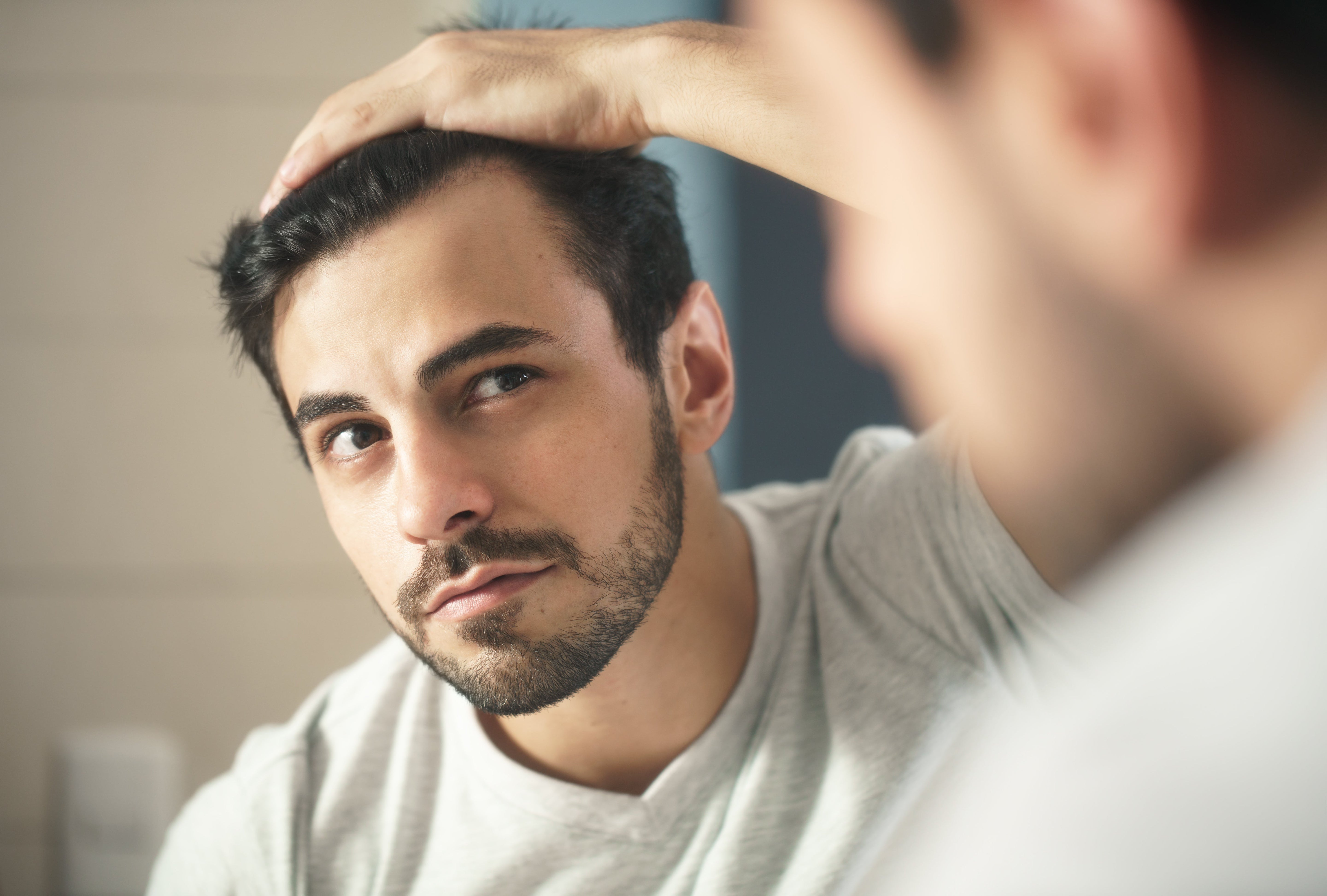 Should You Worry About Your Widow’s Peak Hairline?