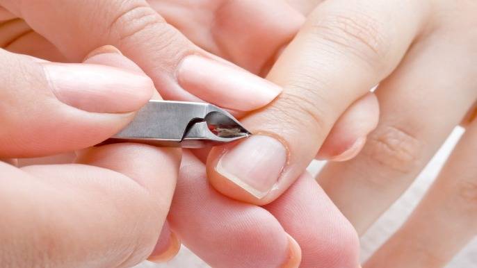 Hangnails? Hell No — Here’s How to Prevent Them